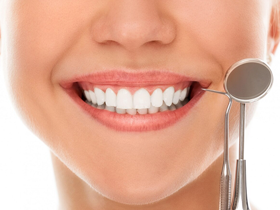 ¿Cuáles son los tipos de carillas dentales?