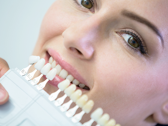 Lo que debes saber antes de realizarte un blanqueamiento dental