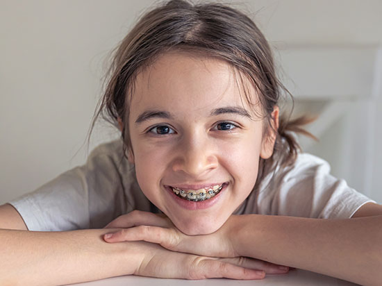 ¿Los niños necesitan brackets o es solo estético?