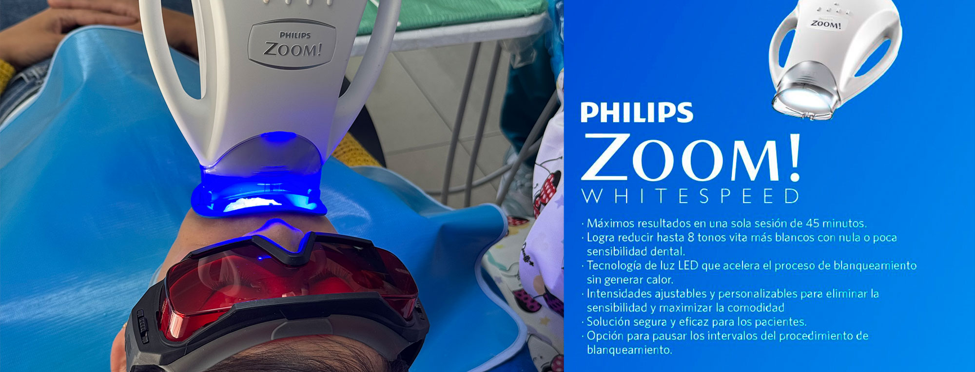 Diferencias entre el blanqueamiento dental tradicional y el sistema Zoom