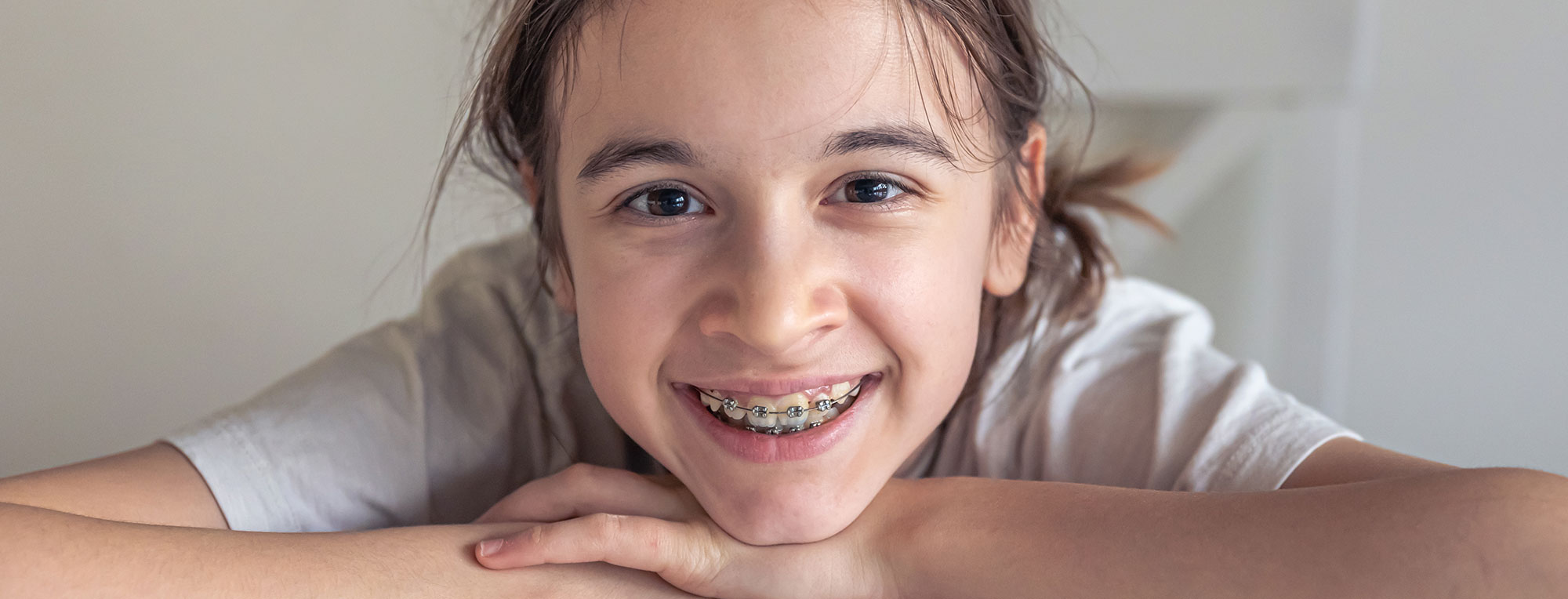 ¿Los niños necesitan brackets o es solo estético?