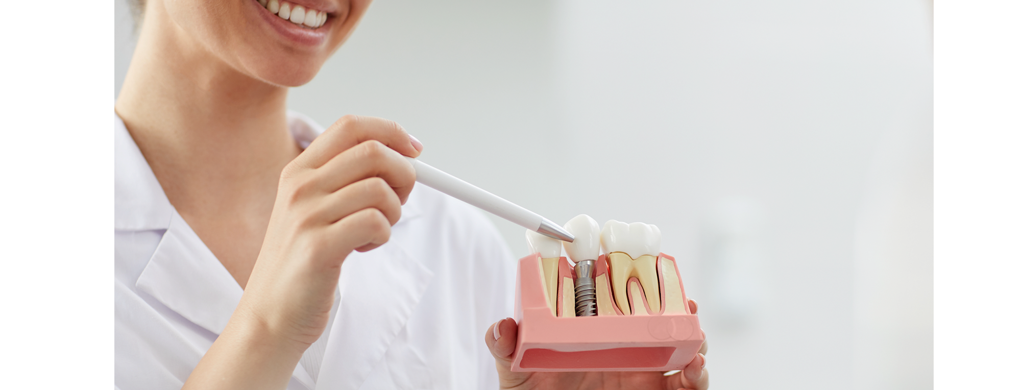 ¿Por qué se coloca un implante dental?